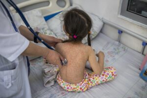 measleskyrgyzstan.tmb 1200v 1