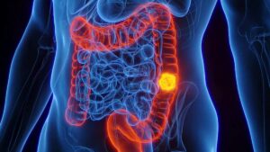 mn colon