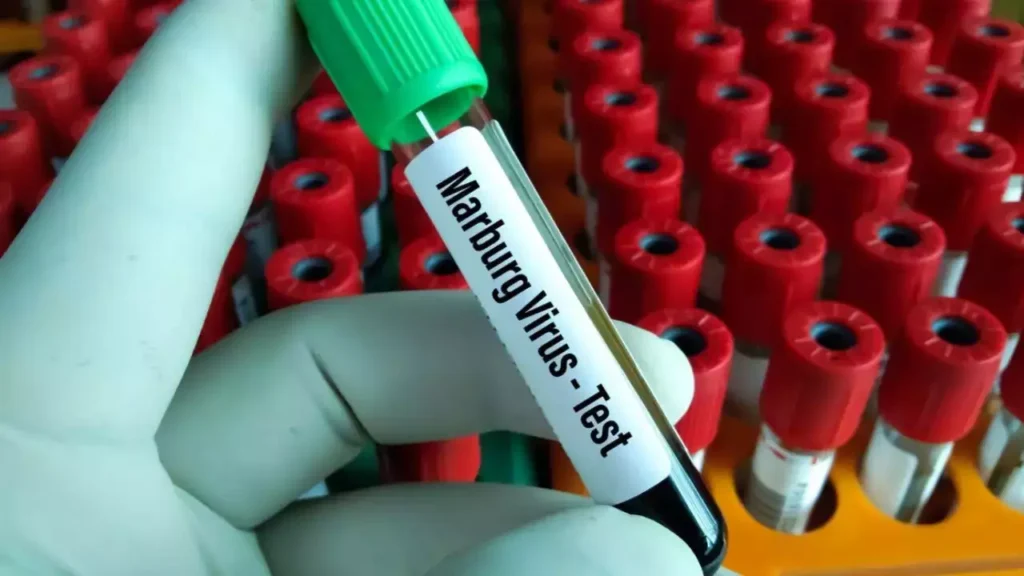 WHO Confirms Marburg Outbreak: 8 Lives Lost in Tanzania. 1 117272633