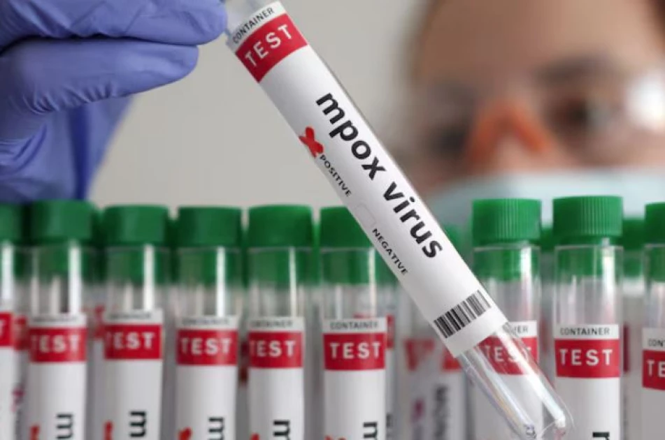 Azerbaijan Confirms First Mpox Case; Patient Isolated and Under Treatment. 1 Mpox og image