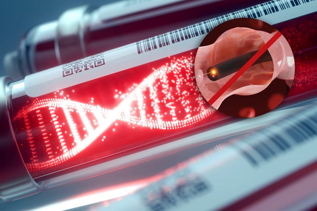 A noninvasive blood test could transform the identification of colonical cancer. 1 WhatsApp Image 2025 01 30 at 10.55.29 AM 1
