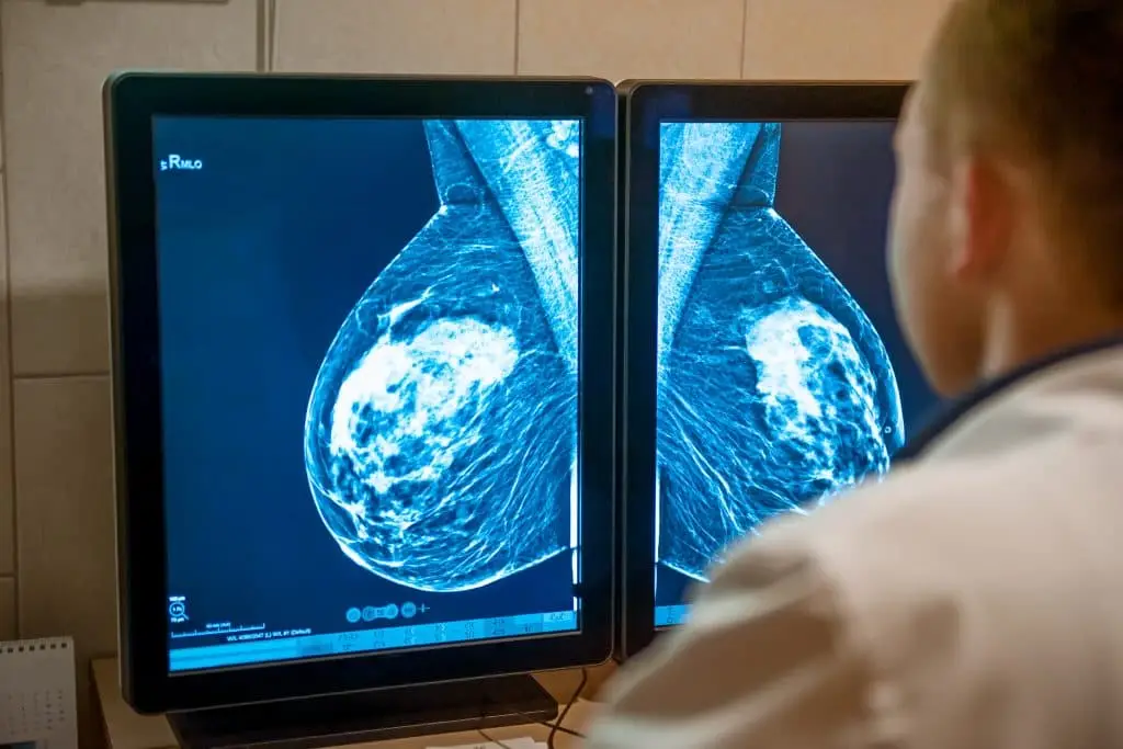 Breakthrough in Breast Cancer Diagnosis: Yonsei Researchers Develop Enhanced Blood Test Technology. 1 blood test main