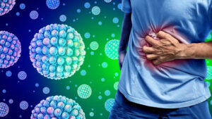 lamnfers norovirus cases surge in the us find out the symptoms causes and treatment 625x300 06 January 25