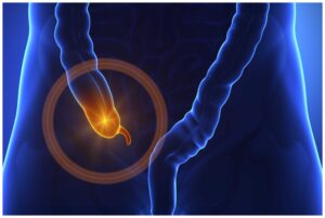 Appendicitis: How to recognize the warning signs