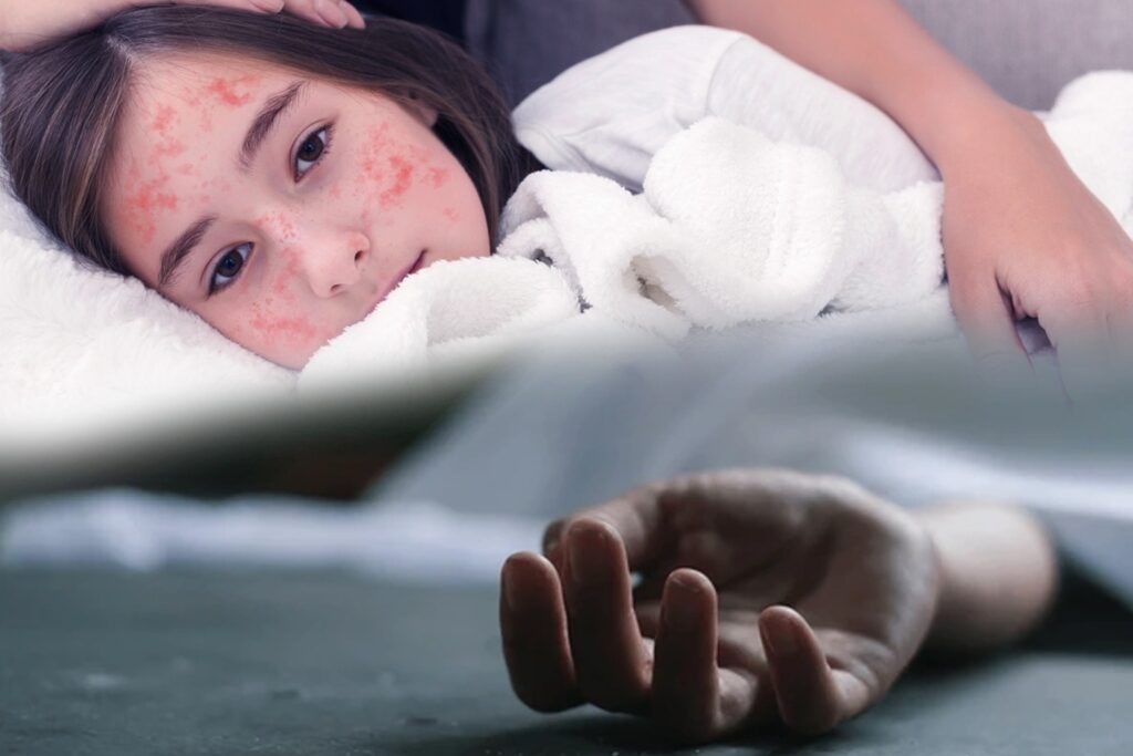 Texas Reports First Measles-Related Death Amid Growing Outbreak 1 Texas news 3