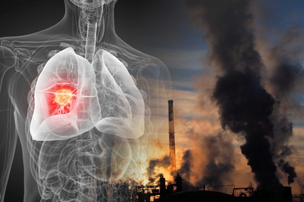 Lung cancer in non-smokers on rise, air pollution could be driver - Study 1 WhatsApp Image 2025 02 04 at 2.53.25 PM