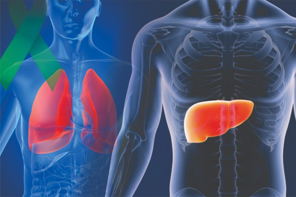 Greater Risk of Lung Metabolic Fatty Liver Disease: Cancer 1 WhatsApp Image 2025 02 04 at 3.17.33 PM