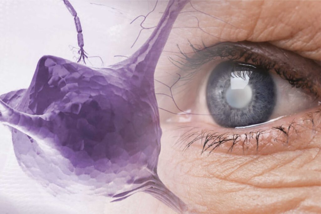 New Research Links Retinal Thickness to Early Detection of Diabetes and Dementia. 1 WhatsApp Image 2025 02 06 at 12.42.36 PM