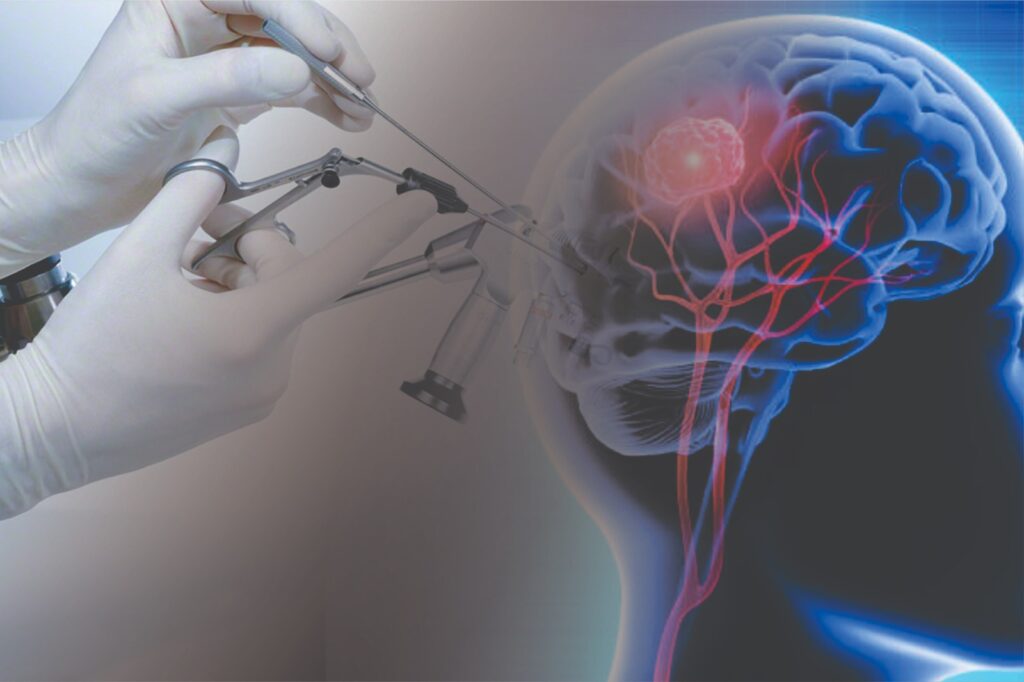 Future of Neuroendoscopy Devices: Rising Demand for Minimally Invasive Brain Surgeries. 1 WhatsApp Image 2025 02 08 at 3.34.34 PM