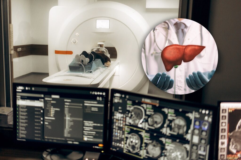Non-Contrast MRI Outperforms Ultrasound in Early Liver Cancer Detection: Study 1 liver cancer