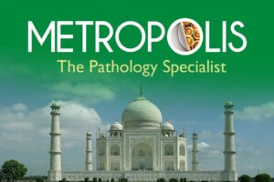 Metropolis