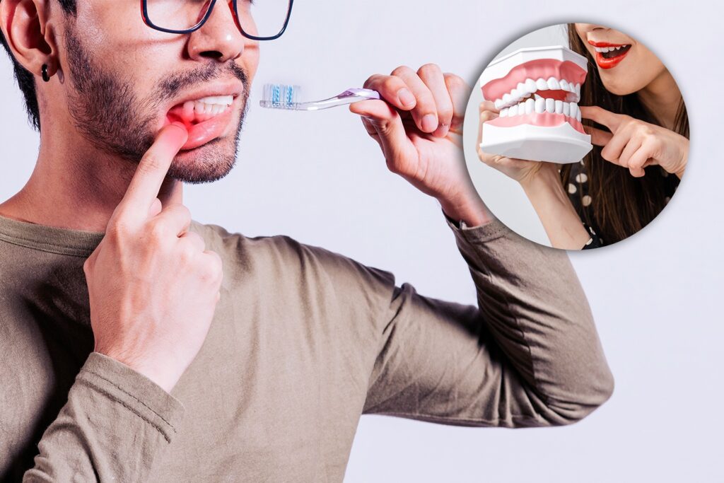 Knowing Gingivitis: Origins, Signs, and Prevention 1 TEETH
