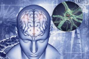 brain NIH
