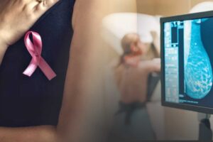Breast Cancer Test Mammography
