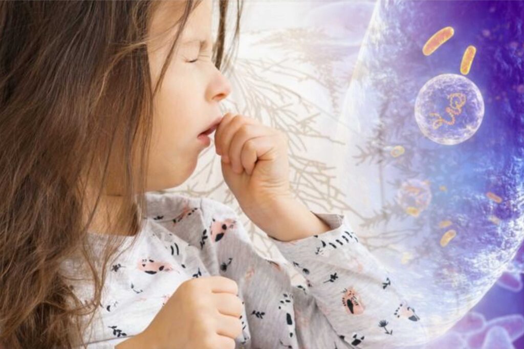 US faces surge in whooping cough cases amid declining vaccination rates 1 US faces surge in whooping cough cases amid declining vaccination rates