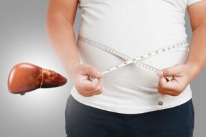 Fatty liver obesity