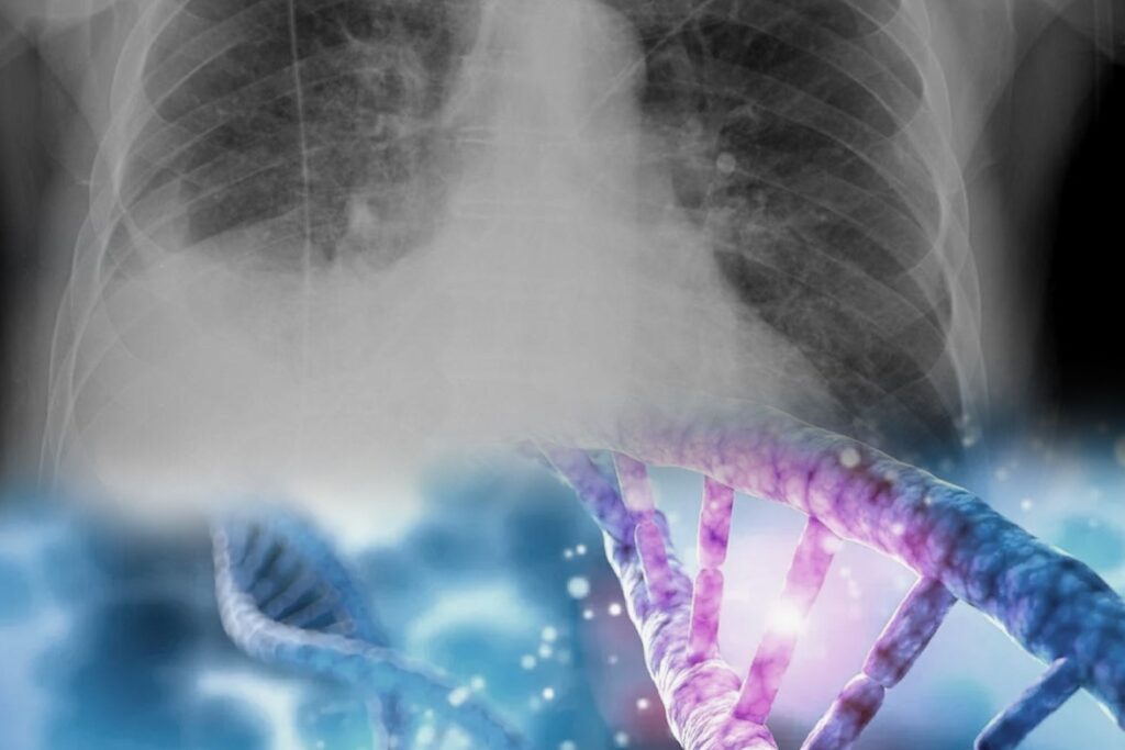 One in 3,000 people at risk of punctured lung from faulty gene: Study 1 Punctured lung