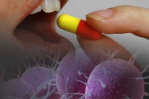 Antibiotic used for UTIs may treat drug-resistant gonorrhoea: Study