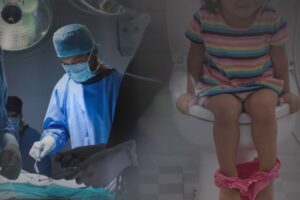Rare surgery helps 2-year-old boy poop naturally again