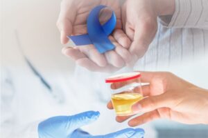 Early prostate cancer detection may be possible with a simple urine test