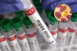 mpox Virus