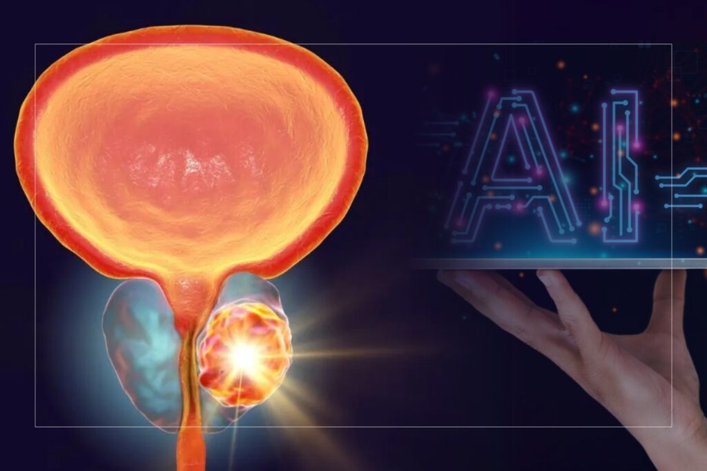 New AI tool predicts which patients benefit most from prostate cancer drug 1 New AI tool predicts which patients benefit most from prostate cancer drug