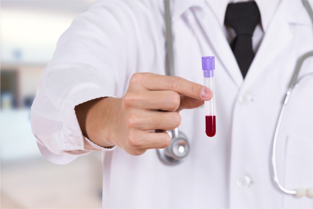 French scientists identify new blood type ‘Gwada negative’ 1 French scientists identify new blood type ‘Gwada negative’