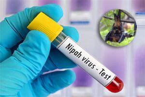 India develops portable test kit for detecting Nipah virus