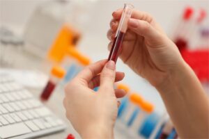 India accelerates sickle cell screening with affordable kits under ₹50