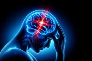 India records one brain stroke every 20 seconds, say experts