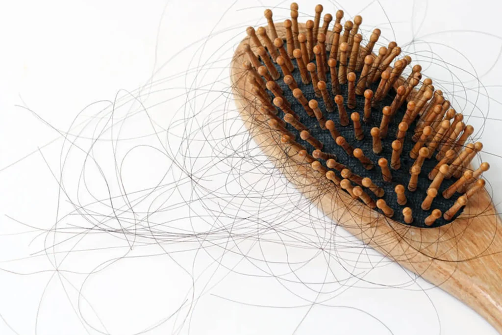Hair fall or hair loss? How to tell the difference and what it means 2 Hair fall or hair loss? How to tell the difference and what it means