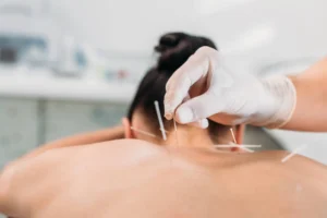 How acupuncture works: The health benefits from tiny needles