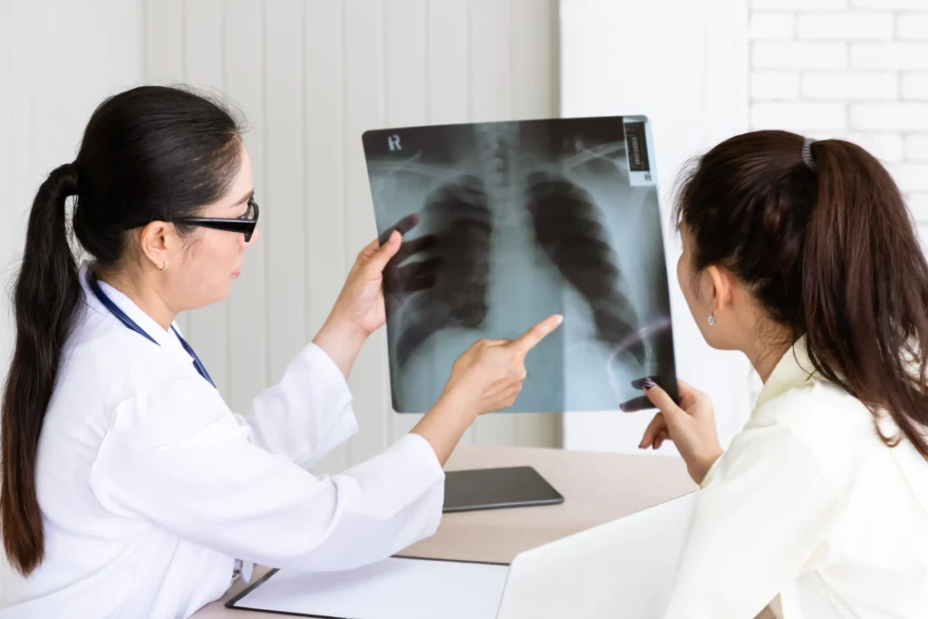 Lung cancer without smoking? Here's what could be causing it 1 Lung cancer without smoking? Here's what could be causing it