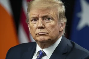 Donald Trump’s legs show signs of common vein condition, not serious illness: White House