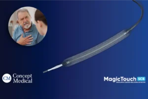Concept Medical enrols first patient in US-Europe trial for next-gen coronary device