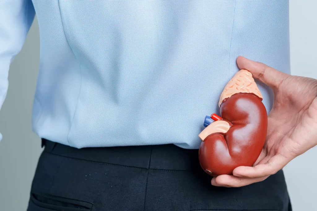 How long does it take to pass a kidney stone? 4 stages explained 1 How long does it take to pass a kidney stone? 4 stages explained