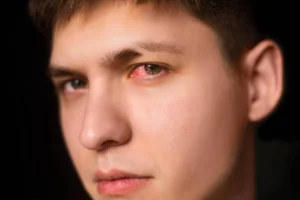 Red, watery eyes? Here’s how to tell if it’s an allergy or infection