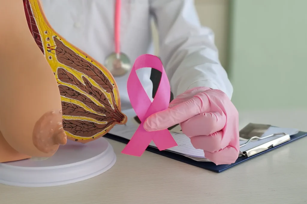 Understanding the five stages of breast cancer: Symptoms and treatment 1 Understanding the five stages of breast cancer
