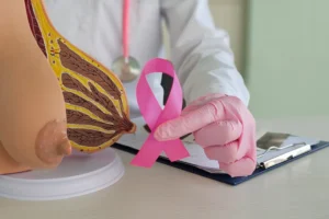 Understanding the five stages of breast cancer: Symptoms and treatment