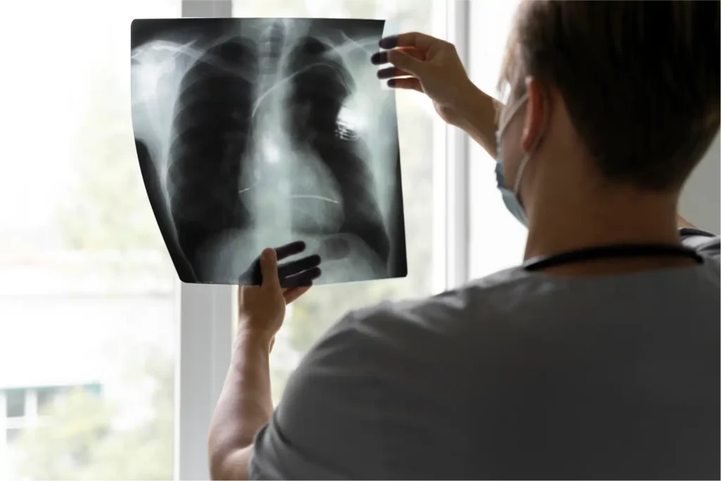 WHO updates TB guidance after Indian study links nutrition to lower risk 1 WHO updates TB guidance after Indian study links nutrition to lower risk