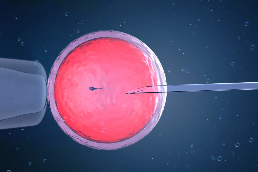 What Is IVF? A Doctor’s Guide to the Most Common Fertility Treatment 1 What Is IVF A Doctor’s Guide to the Most Common Fertility Treatment