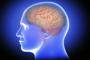 What is a mini stroke? Warning signs you shouldn’t ignore