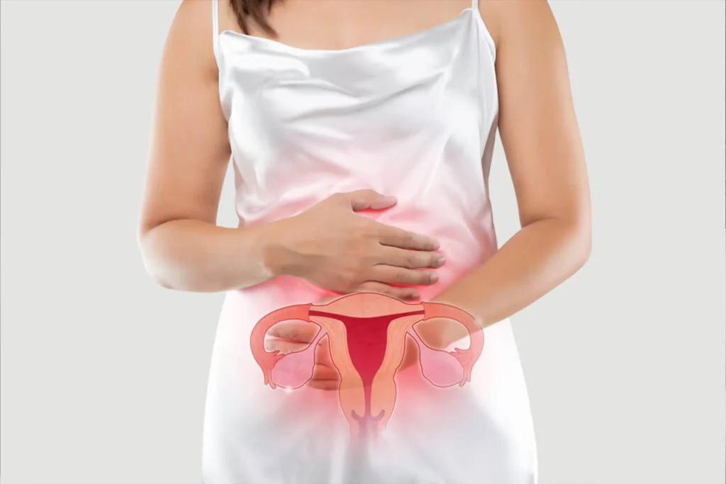 What is endometriosis? The hidden struggle millions of women face