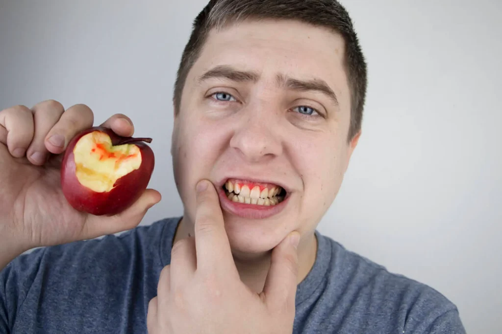 What your gums reveal about your health: Signs you shouldn't ignore 1 What your gums reveal about your health: Signs you shouldn't ignore
