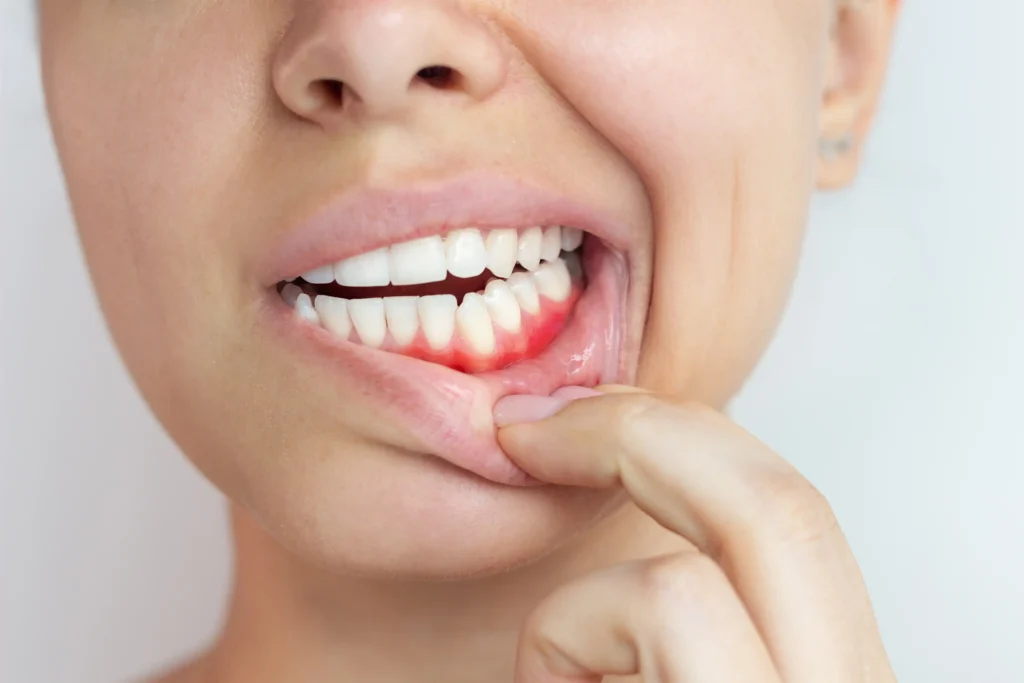What your gums reveal about your health: Signs you shouldn't ignore 2 What your gums reveal about your health: Signs you shouldn't ignore