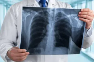 Experts warn of fast-declining lung health in young Indians
