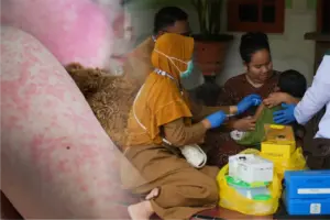 Indonesia’s measles outbreak persists; mobile teams fan out as halal concerns slow uptake