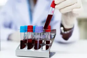 Scientists develop ultrasensitive blood test for early Alzheimer’s detection