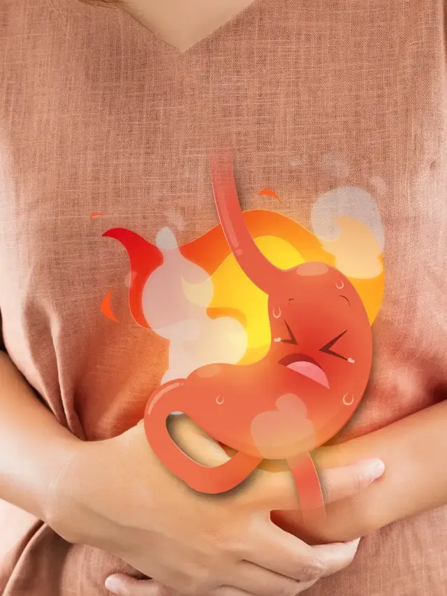 How to get instant relief from acidity