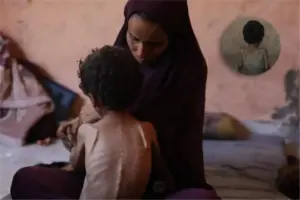 54,600 under-5s acutely malnourished in Gaza, shows UN study